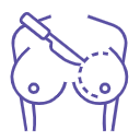 Breast Reduction