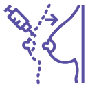 Fat Injection Augmentation